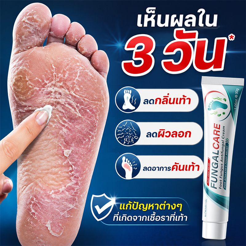 ครีมระงับกลิ่นเท้า ครีมทาเท้า ลดอาการคันเท้า กลิ่นเท้า เชื้อราที่เท้า ซึมไว บำรุงผิวเท้า