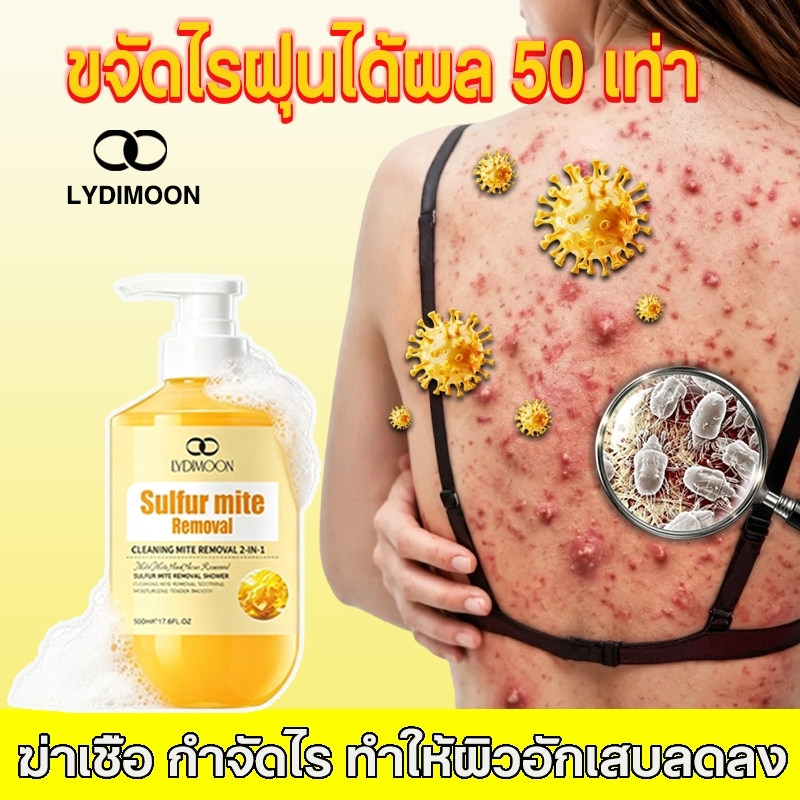LYDIMOON เจลอาบน้ำฆ่าเชื้อ บรรเทาอาการคัน ขนาด 500 มิลลิลิตร ครีมอาบน้ำกำมะถัน ช่วยลดรอยดำ ผื่น และส