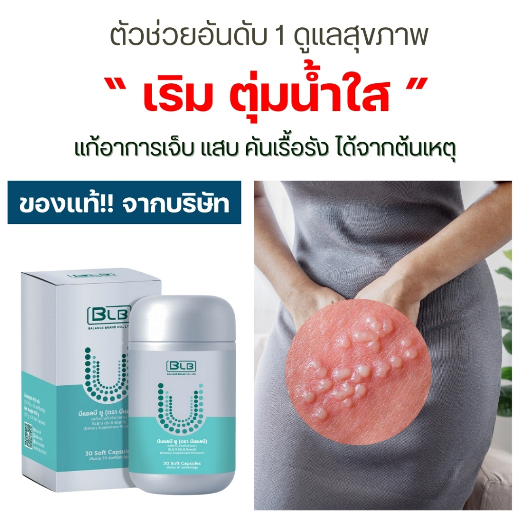 สมุนไพรรักษาเริม ตุ่มน้ำใส แสบ คัน ด้วย Balance UCore | บาลานซ์ยูคอร์ ของแท้ 100% ส่งตรงจากบริษัท
