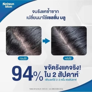 แชมพูขจัดรังแค เซลซั่น Selsun Blue Anti-Dandruff Shampoo 120ML 1ขวด