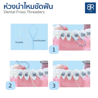 BERRA ห่วงร้อยนำไหมขัดฟัน ห่วงนำไหมขัดฟัน ทำความสะอาดฟัน 5/10เส้น Dental Floss Threaders