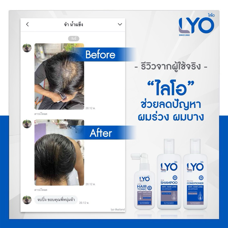 [แพ็ค 3 ขวด ราคาพิเศษ] LYO HAIR TONIC ไลโอ แฮร์โทนิค (100 ml.) x 3 ขวด - รูปที่ 6