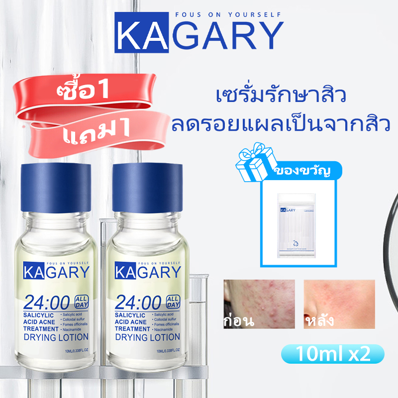 [1 แถม 1]Kagary Anti acne Serum ลดรอยแดง ลดการอักเสบ ช่วยลดรูขุมขนและสิว รักษาสิว Salicylic Acid Acne Lotion 10ml