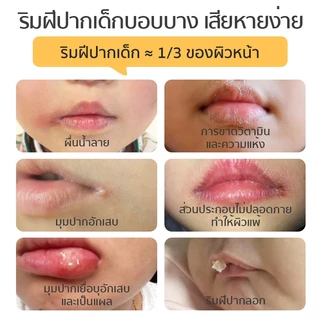 Dexter Baby ลิปมัน แม่และเด็ก เหมาะสำหรับ ธรรมชาติ100% lipbalm ริมฝีปาก นุ่ม ชุ่มชื้น