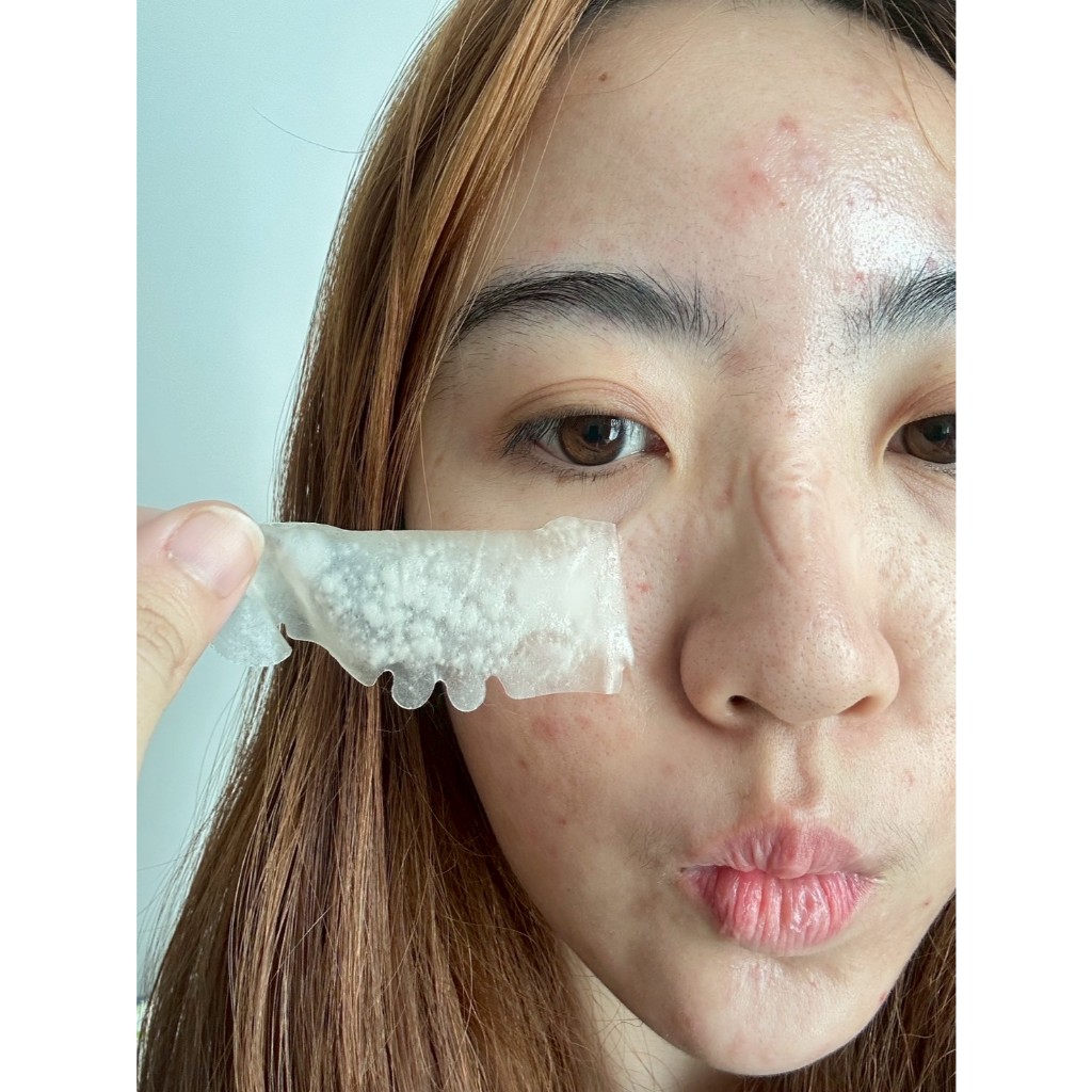 แผ่นแปะดูดซับสิว จมูก ไซส์ใหญ่ Puretec MaxAbsorb Acne Patch - Nose