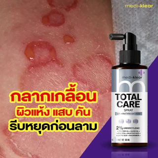 (เมดิเคลียร์) Medi-Klear สเปรย์สิวหลัง ขนคุด ผื่นคัน ผิวเชื้อรา Total Care Spray