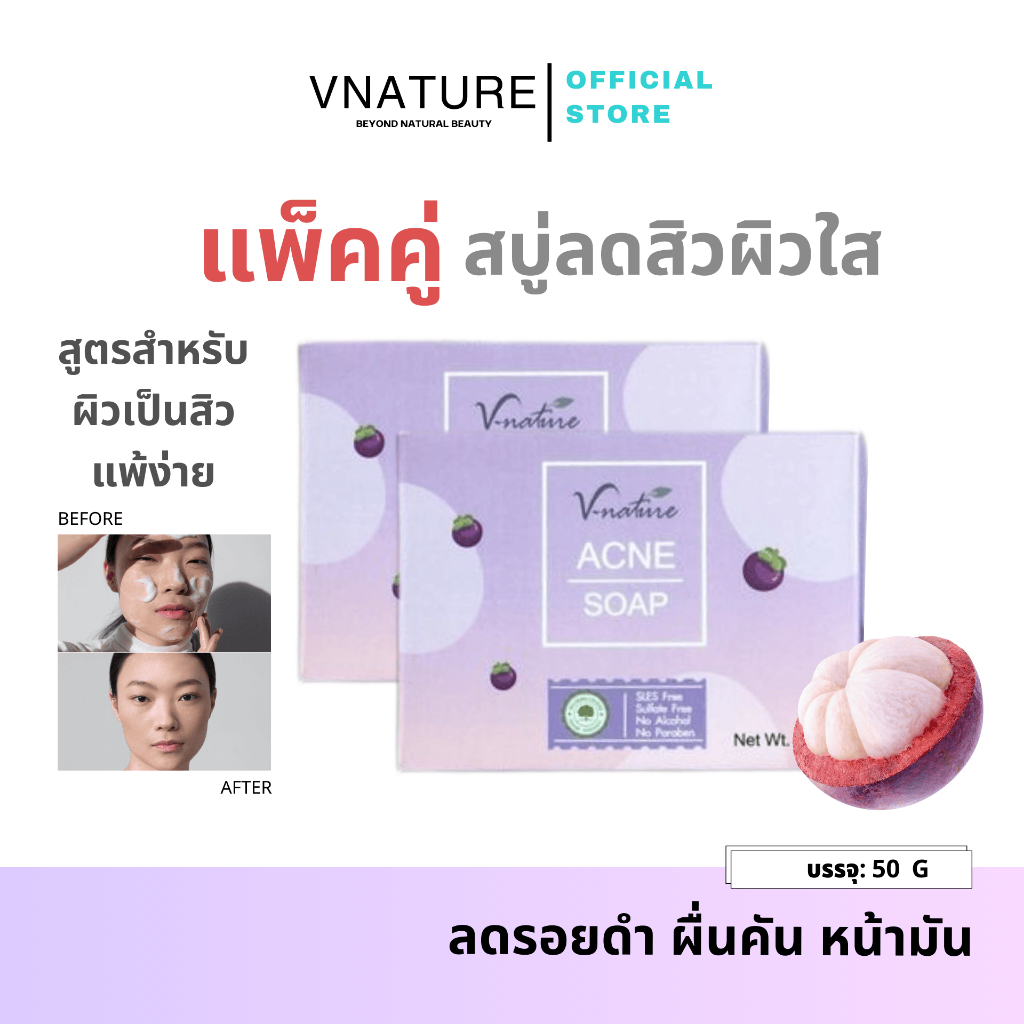 สบู่ลดสิว รอยสิว VNATURE Pimple&Whitening Soap สิวอุดตัน สิวอักเสบ ลดสิวผด สิวหลัง สบู่แก้สิว ผิวใส