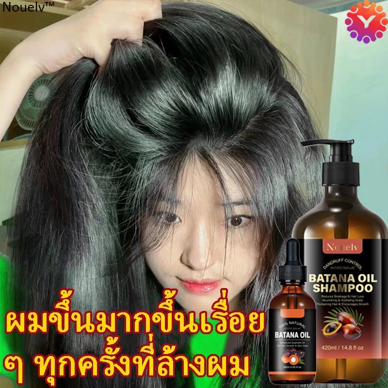 Nouelv batanaoil แชมพูแก้ผมร่วง ยาสระผมเร่งยาว ยาสระผมแก้ร่วง 420ml สูตรน้ำขิง ปลูกผมอย่างอ่อนโยน บำรุงรากผม แชมพูปลูกผม