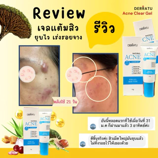 เจลแต้มสิว DERRATU 6g แต้มสิวยุบไว เร่งรอยสิวหาย สิวอักเสบ สิวอุดตัน สิวไตแข็ง สิวผด รอยสิว