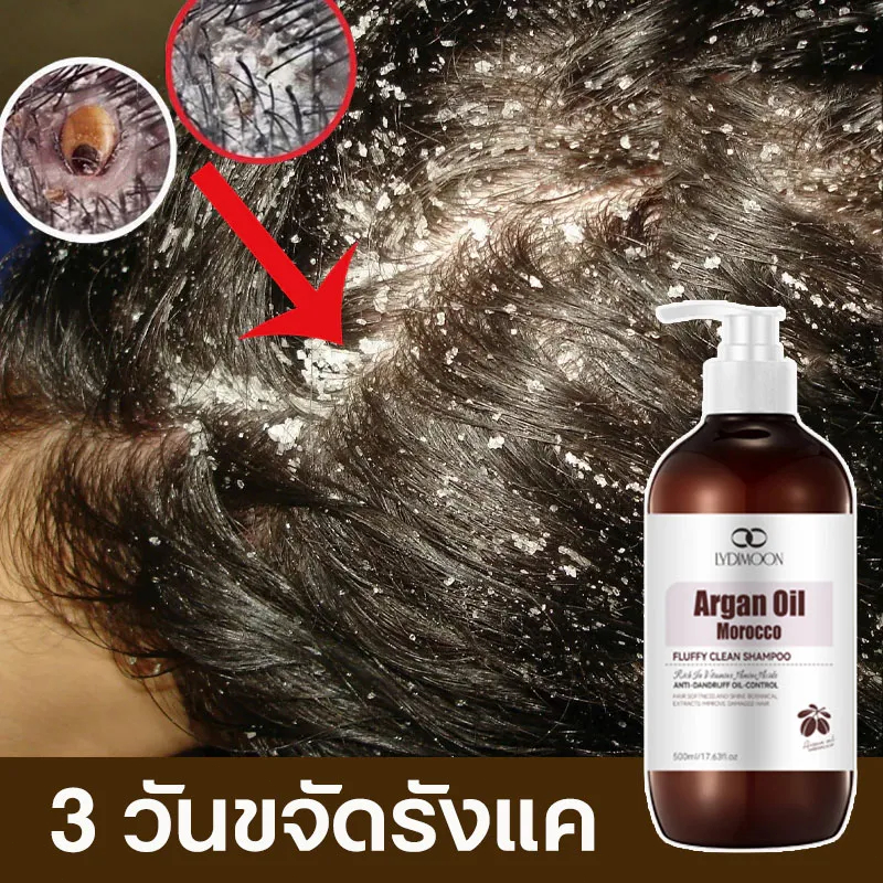 แชมพูผมบาง LYDIMOON แชมพูขจัดรังแค แชมพูรังแค 500ml กู้ผมเสีย กลิ่นหอมติดทนนาน ฟื้นบำรุงหนังศีรษะ คุมน้ำมัน ชุดสระผมดูแ