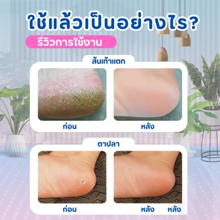 ซิลิโคนรองส้นเท้า ซิลิโคนถนอมส้นเท้า แก้ปวดส้นเท้า รองช้ำ ส้นเท้าแตก ฟรีไซส์ Silicone Heels Cover