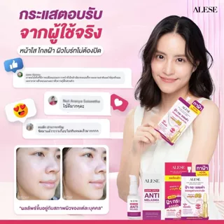(โปรเดือน 8.8.) ALESE Dark Spot And Melasma Concentrate Cream 30 g ครีมเนื้อเซรั่มสูตรเข้มข้น ดูเเลฝ้า รอยดำรอยเเดงดูจ