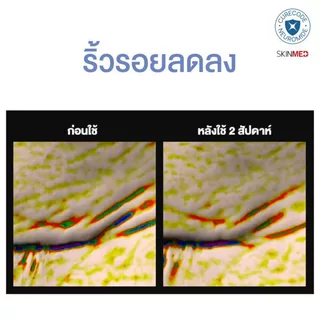 CURECODE EXONAD+ FIRMING MASK 1 แผ่น