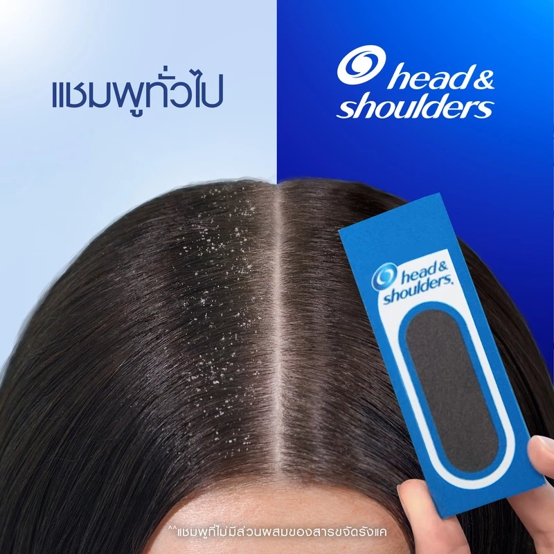 [แพ็คคู่] Head and Shoulders แชมพูขจัดรังแค สูตร คูล เมนทอล 370 มล x2 ขวด|Anti Dandruff Shampoo Cool Menthol 370 ml x2 thumbnail 7