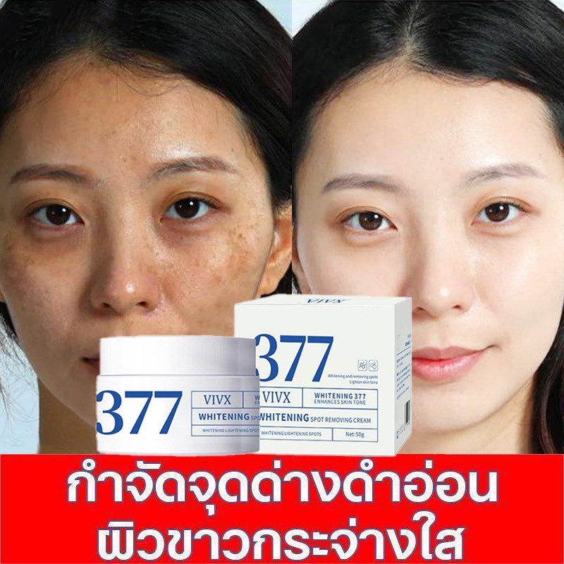 ครีม 377 50g ลดริ้วรอยและจุดด่างดำ บำรุงผิวขาวกระจ่างใส มอยเจอร์ไรเซอร์ ครีมทาหน้า ครีมบำรุงผิว รอยสิวจางลง ผิวชุ่มชื้น