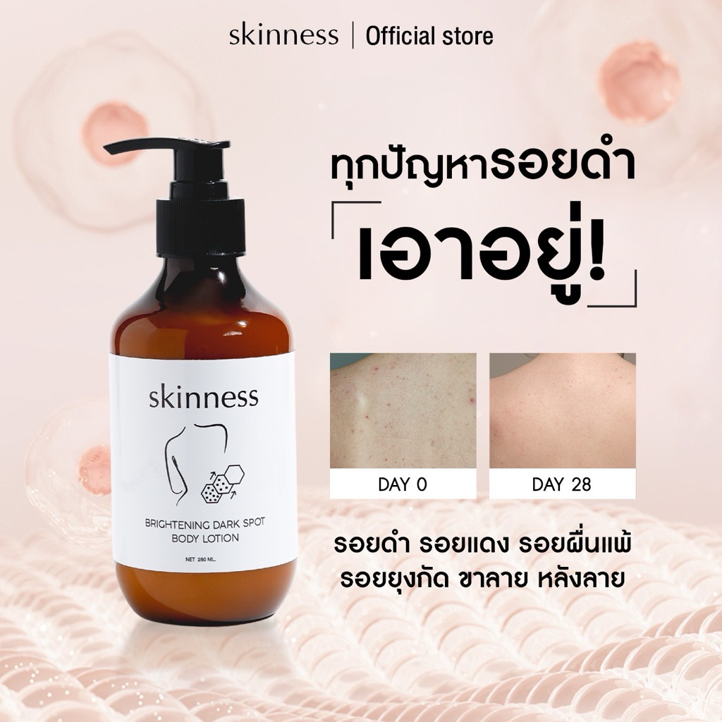 [พร้อมส่งทุกวัน] skinness brightening dark spot body lotion | ครีมลดรอยผิวกาย