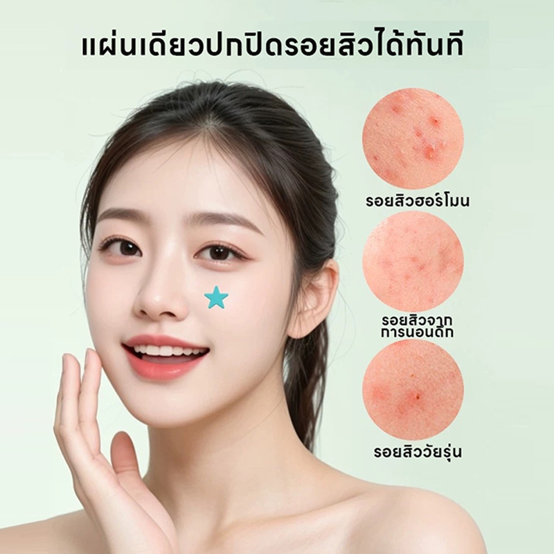 แผ่นแปะสิว สกินแคร์ แผ่นแปะสิวชับบี้