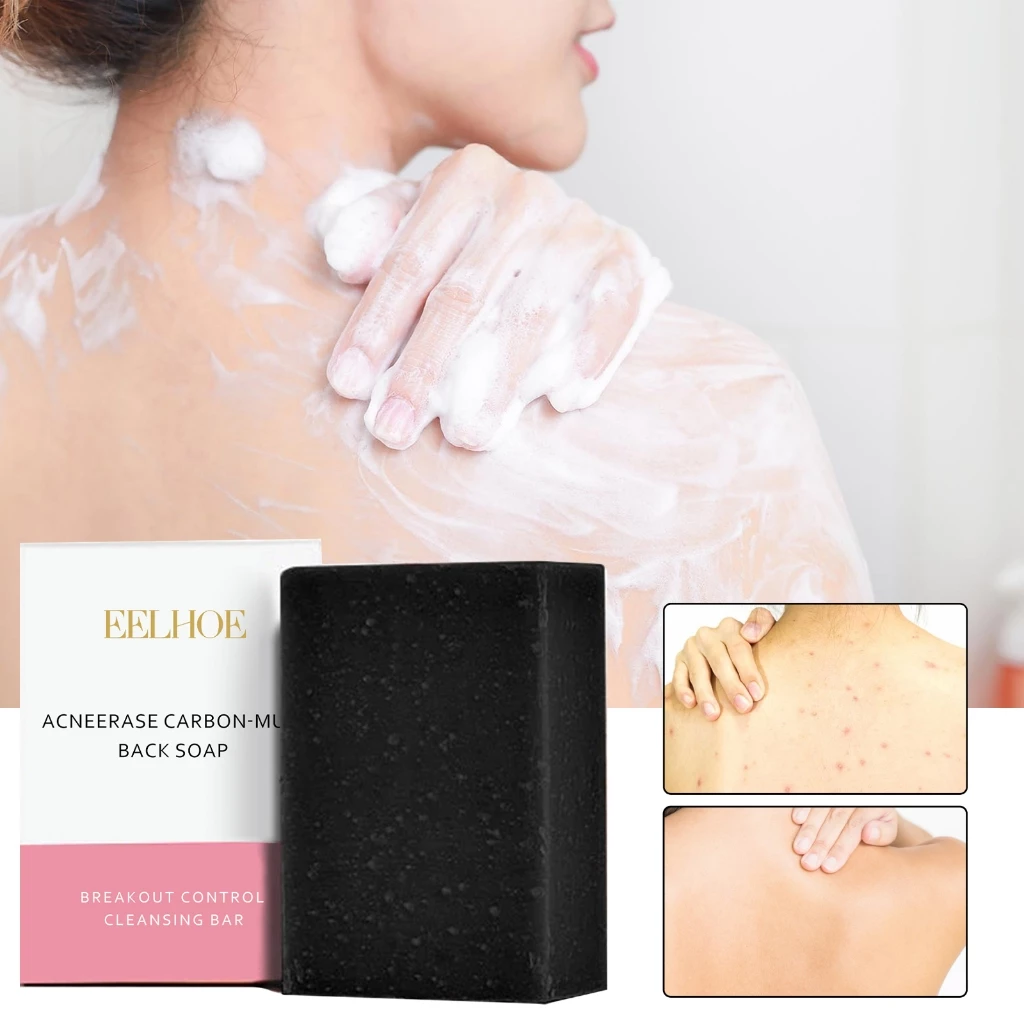 EELHOE สบู่คาร์บอน Carbon-Mud Back Soap thumbnail 3