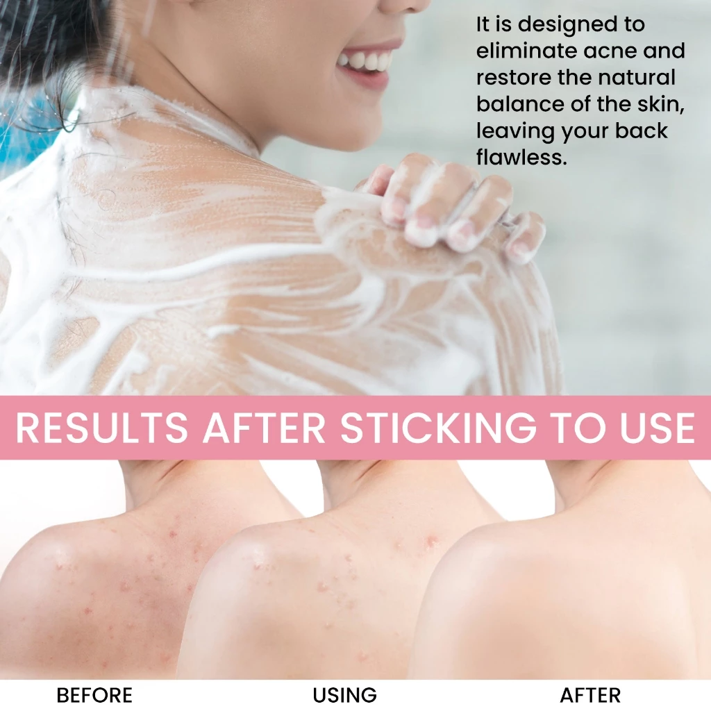 EELHOE สบู่คาร์บอน Carbon-Mud Back Soap thumbnail 5