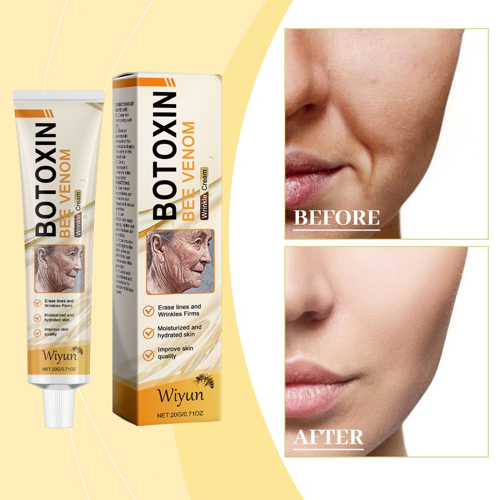 Wiyun ครีมบำรุงผิวผึ้ง เพิ่มความยืดหยุ่นของผิว กลับมามีชีวิต อ่อนโยนปลอดภัยไม่ระคายเคือ ง