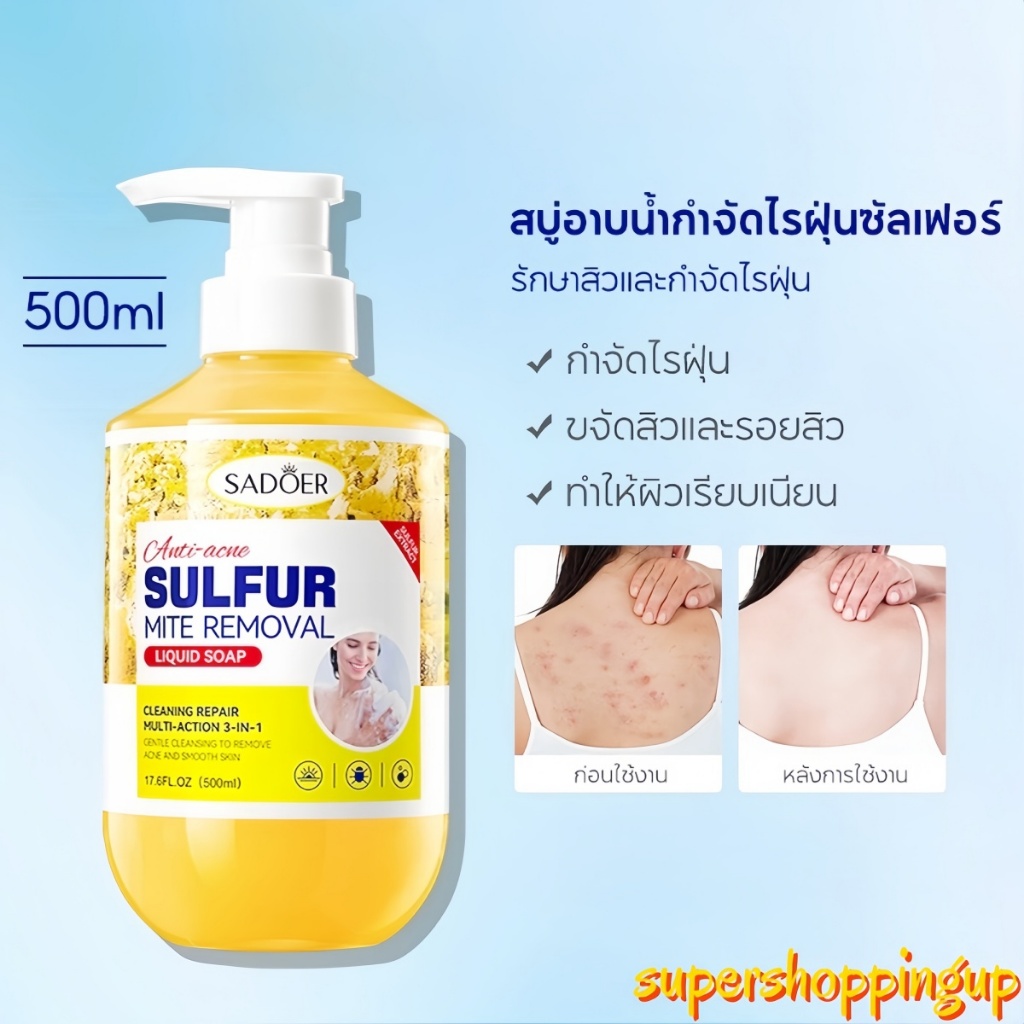 SADOER Acne Clear Anti-Mite Sulfur Bath Gel ซัลเฟอร์ ครีมอาบน้ำ กำจัดไรฝุ่น ปรับปรุงผิวคัน อ่อนโยน