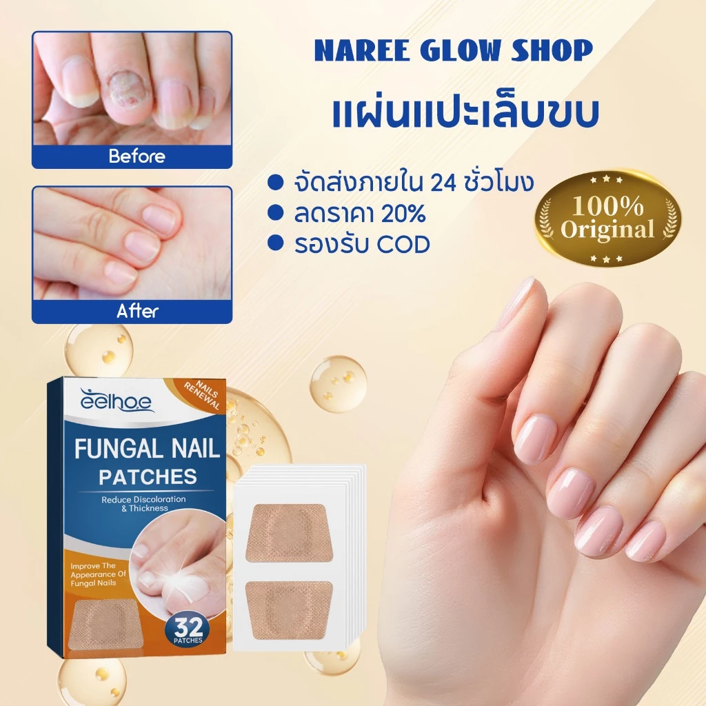 EELHOE แผ่นแปะเล็บขบ เล็บขบ ซ่อมเล็บ เทปแปะป้องกันเล็บขบนิ้วเท้า แผ่นแปะดูแลเล็บเท้า สติ๊กเกอร์เล็บขบ แผ่นติดเล็บขบ