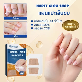 EELHOE แผ่นแปะเล็บขบ เล็บขบ ซ่อมเล็บ เทปแปะป้องกันเล็บขบนิ้วเท้า แผ่นแปะดูแลเล็บเท้า สติ๊กเกอร์เล็บขบ แผ่นติดเล็บขบ