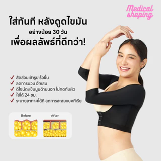 Medical shaping ชุดกระชับหลังดูดไขมัน ชุดกระชับสัดส่วนดูดไขมัน ชุดหลังดูดไขมัน เกรดทางการแพทย์