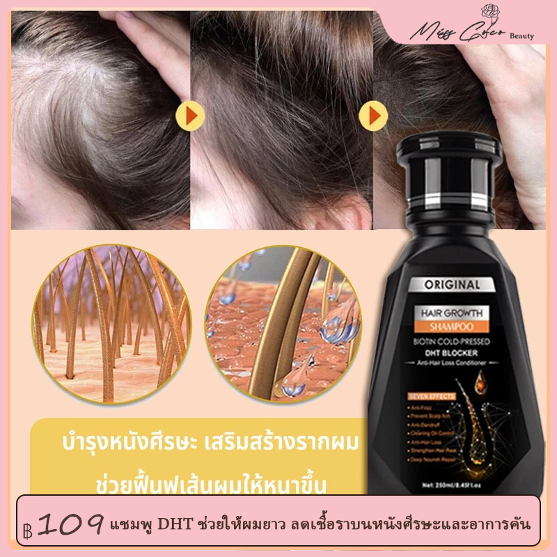 คอมโบ แชมพูสระผม DHT 2 ขวด - แชมพู DHT ช่วยให้ผมยาว ลดเชื้อราบนหนังศีรษะและอาการคัน