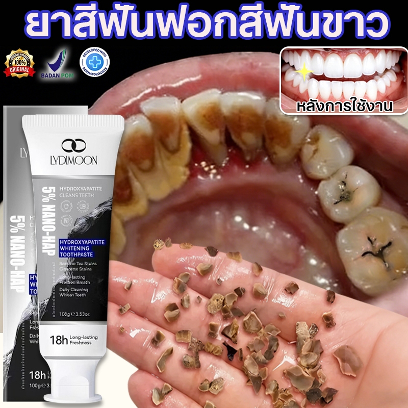 LYDIMOON ยาสีฟันซ่อมแซมด้วยนาโนไฮดรอกซีอะพาไทต์ 5% ยาสีฟันฟันขาว 100g ฟอกสีฟันขาว ขจัดคราบหินปูน ลดก