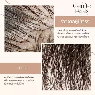 ทรีทเมนท์บำรุงผม เพียงหมักแล้วสระ ลดผมร่วง ทรีทเม้นท์บำรุงผม น้ำมันละหุ่ง ออยล์บำรุงผม ลดรังแค