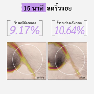 Spring Letter Toner Pad แผ่นมาส์ก VC ลดริ้วรอย ยกกระชับผิว เพิ่มความยืดหยุ่น ผิวกระจ่างใส ผิวกระชับ หน้าเต่งตึง 60 แผ่น