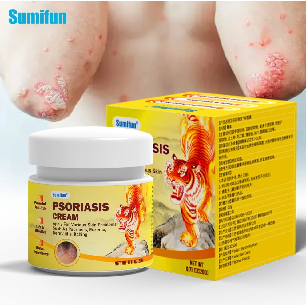 sumifun Psoriasis Cream Antifungal cream Eczema cream Cream แบ่งปันอาการคันกับอาการคัน