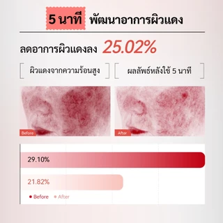 Spring Letter Toner Pad แผ่นมาส์กเซนเทลล่า ปลอบประโลมผิว ลดรอยแดง บำรุงผิวแพ้ง่าย ปลอบประโลมอย่างเร่งด่วน บำรุงผิว