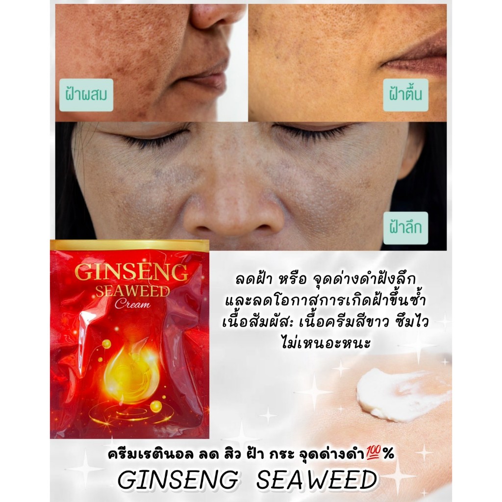 ครีมเรตินอลเมโส หน้าใส สุดยอดครีมล้างฝ้า กระจุดด่างดำ