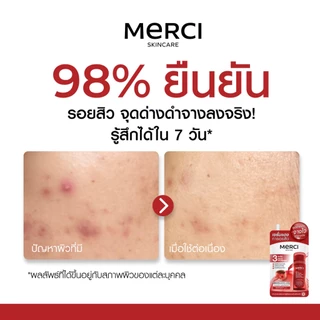 (Clearance x 3ซอง) Merci Red Power Anti-Dark Spot Brightening Superior Serum เซรั่ม เมอร์ซี่ ลดรอยสิว รอยดำ รอยแดง