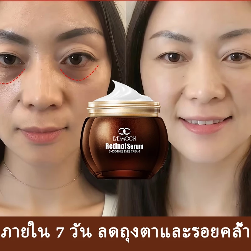 เรตินอลอายครีม ครีมทาใต้ตา Eye Cream Anti-Aging อายครีม35g ลดริ้วรอย ลดถุงน้ำใต้ตา ลดรอยคล้ําใต้ตา ลดริ้วรอยตีนกา ให้คว