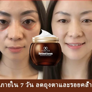 เรตินอลอายครีม ครีมทาใต้ตา Eye Cream Anti-Aging อายครีม35g ลดริ้วรอย ลดถุงน้ำใต้ตา ลดรอยคล้ําใต้ตา ลดริ้วรอยตีนกา ให้คว