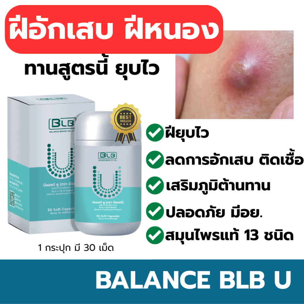 ฝีอักเสบ ฝีคัณฑสูตร ทานสูตรนี้วันละ 1 เม็ด Balance BLB U สมุนไพร 13 ชนิด ของแท้ ส่งตรงโดยบริษัท