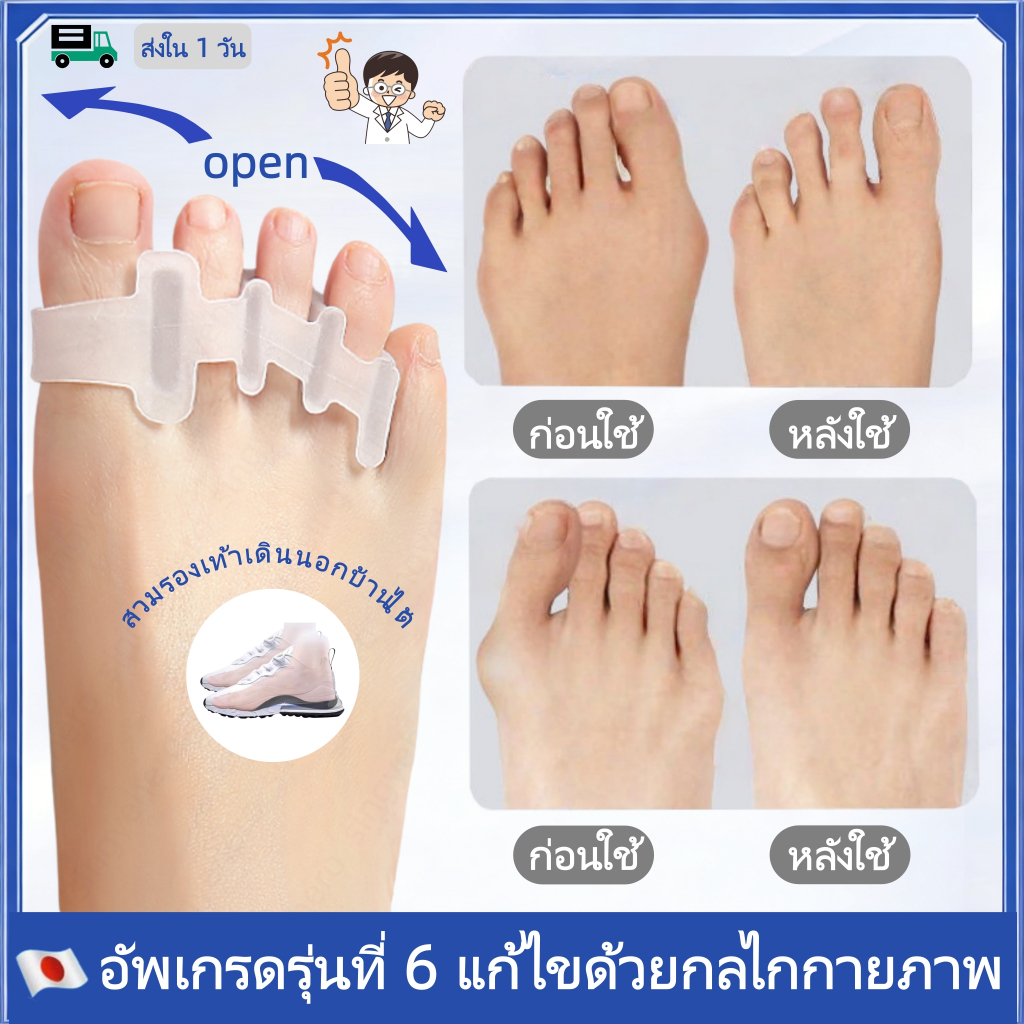 ซิลิโคนแยกนิ้วเท้า 5 ช่อง ที่คั่นนิ้วเท้า การแก้ไขนิ้วเท้าใหญ่สามารถบรรเทาอาการปวดเท้าได้ ทาอาการพลิก ใส่สบาย