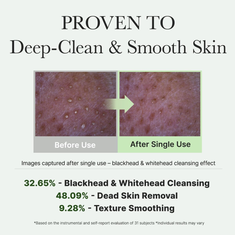 Arencia Korean Rice Mochi Face Cleanser โฟมล้างหน้า มาส์ก+สครับ ข้าวเกาหลี กรีนที มักวอร์ต ขจัดสิวเสี้ยน กระชับรูขุมขน พ ราคา ถูกที่สุด ดีลบีเคเค แกลเลอรีภาพที่ 5