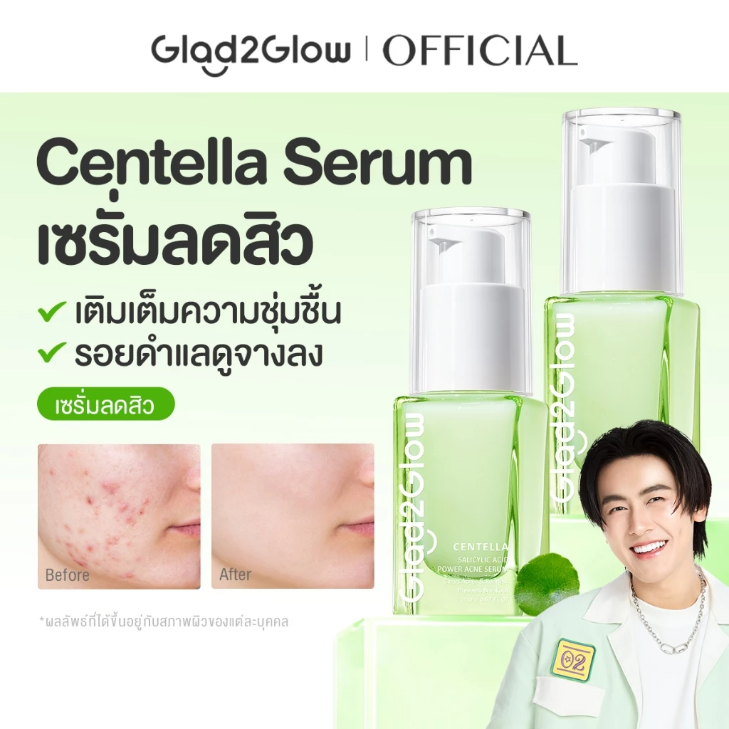 【Proxie's Pick】Glad2Glow Centella Salicylic Acid Acne Serum เซรั่ม เซรั่มบำรุงผิวหน้า เซรั่มลดรอยสิว เซรั่มหน้าใส