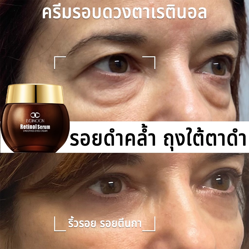 เรตินอลอายครีม 5D Retinol Anti-Aging อายครีม 35g ลดริ้วรอย กระชับใต้ตา ขอบตาคล้ำ ลดถุงใต้ตา ฟื้นฟูรอบดวงตา ผิวแพ้ง่าย