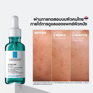 ลา โรช-โพเซย์ La Roche-Posay EFFACLAR SERUM 30ml. เซรั่ม 3พลังโมเลกุลสลายสิวอุดตันที่ต้นตอ 30ml.(เซรั่มบำรุงผิวหน้า)