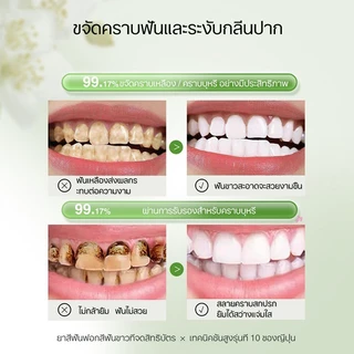 VIVX ยาสีฟัน ยาสีฟันฟันขาว ฟอกฟันขาว 120g ยาสีฟันขจัดปูน ขจัดคราบเหลือง ยาสีฟันขจัดหิน ลดกลิ่นปาก teeth whitening