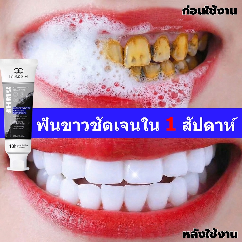 LYDIMOON ยาสีฟัน ยาสีฟันฟอกฟันขาว ฟอกสีฟัน ขจัดคราบหินปูนสีเหลือง ขจัดคราบชากาแฟ ให้ลมหายใจสดชื่น ลด
