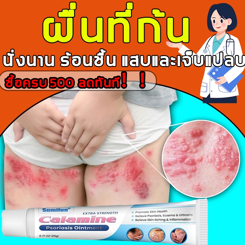 【มีประสิทธิภาพ 100%】ครีมลดอาการคัน ทากากเกลื้อน สารสกัดจากพืชใช้ได้ทั้งตัว สารสกัดจากพืชใช้ได้ทั้งต 20g