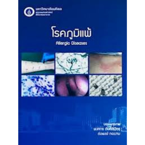 หนังสือ โรคภูมิแพ้ ALLERGIC DISEASES //พงศกร ตันติลีปิกร และคณะ : 9786168201114