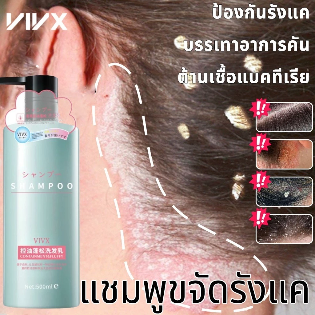 ยาสระผมขจัดรังแค แชมพูรังแค ยาสระผม 500ml ขจัดรังแค ลดคันหัว หยุดอาการคัน ลดผมร่วง แชมพูรักษาเชื้อราบนหนังศรีษะ