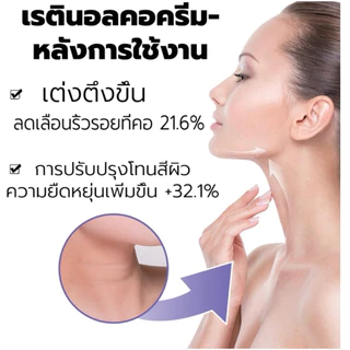 [1 แถม 1] EELHOE Retinol Neck Cream ครีมบำรุงผิวลำคอ เรตินอล ช่วยลดเลือนริ้วรอย ให้ผิวดูตึงกระชับ ชุ่มชื้น (40g)